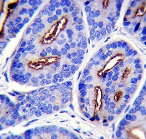 PSMA antibody immunohistochemistry analysis in formalin fixed and paraffin embedded human prostate c
