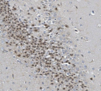 IHC staining of FFPE rat brain with Rad9b antibody. HIER: boil tissue sections in pH8 EDTA for 20 mi
