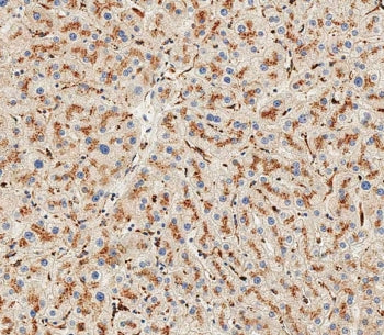 IHC testing of FFPE human liver tissue with Hexosaminidase A antibody. HIER: steam section in pH9 ED