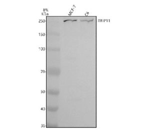 Western blot analysis of TRIP11 using anti-TRIP11 antibody. Electrophoresis was performed on a 8% SD
