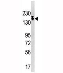 Western blot analysis of SETDB1 antibody and Ramos lysate. Predicted molecular weight ~143 kDa (unmo