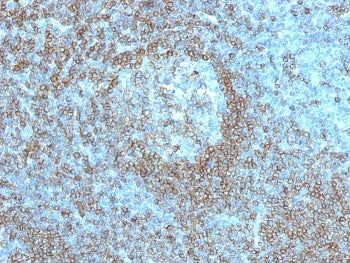 IHC staining of FFPE human tonsil with CD45RA antibody (clone K4B5). HIER: steam section in pH 9 10m