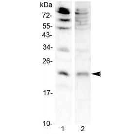 Keratinocyte Growth Factor Antibody / KGF (FGF7)