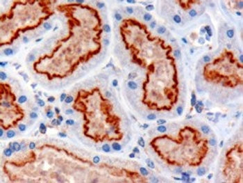 IFT88 Antibody