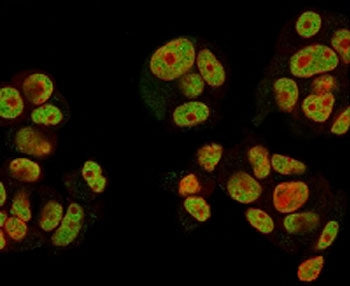 Immunofluorescent staining of human MCF7 cells with Neuregulin-1 antibody (clone NRG1/2752, green) a