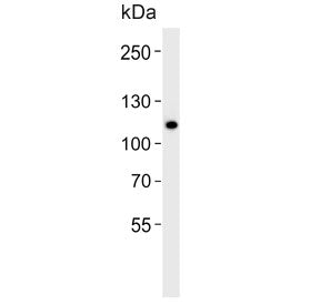 Western blot testing of human WiDr cell lysate with CARD6 antibody. Predicted molecular weight ~116