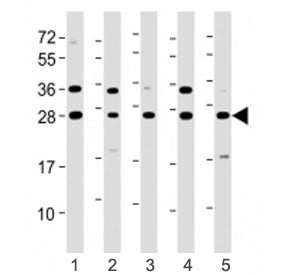 Western blot testing of ERAB antibody at 1:8000: Lane 1) human HeLa, 2) HepG2, 3) Jurkat, 4) K562 an