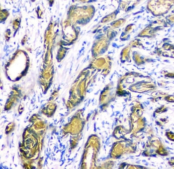 PSA Antibody (Prostate Specific Antigen)