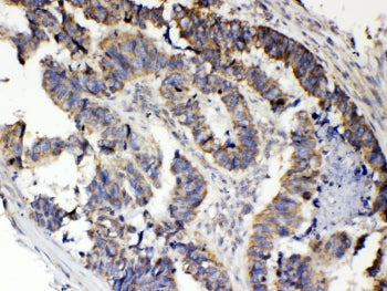 RANK Antibody