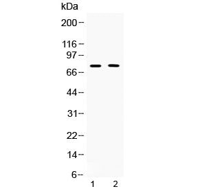Western blot testing of 1) rat thymus and 2) human COLO320 lysate with TRF2 antibody at 0.5ug/ml. Pr