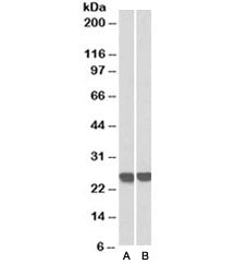 Western blot of MOLT4 (A) and human thymus (B) lysates with GRB2 antibody at 0.3ug/ml. Predicted mol