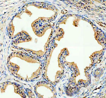 IHC analysis of NCOA2 using anti-NCOA2 antibody. NCOA2 was detected in a paraffin-embedded section o