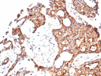 PTEN Antibody