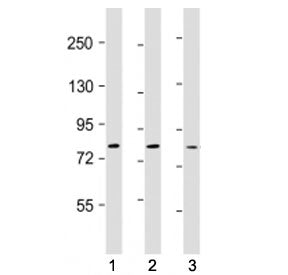 Western blot testing of TLR2 antibody at 1:500: Lane 1) human Ramos, 2) A549 and 3) MDA-MB-231 cell