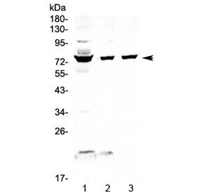 FUS Antibody / TLS