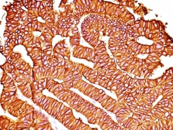 EpCAM Antibody