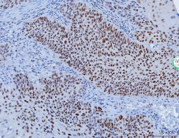 YY1 Antibody