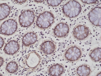 IHC testing of formalin fixed and paraffin embedded human colon tissue with recombinant ITGB1 antibo