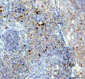 IHC staining of FFPE mouse spleen tissue with TCP1 antibody, HRP-labeled secondary and DAB substrate