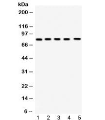 Western blot testing of 1) rat testis, 2) rat ovary, 3) mouse testis, 4) mouse ovary and 5) human He
