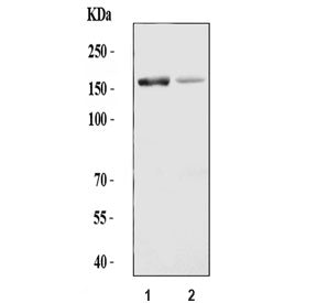 Western blot testing of 1) rat liver and 2) mouse liver tissue lysate with ADAMTS13 antibody. Predic