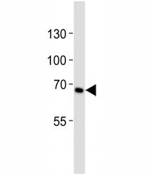 Western blot analysis of lysate from HeLa cell line using CD30 antibody diluted at 1:1000. Predicted