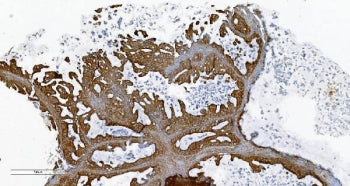 Phospholipid transfer protein Antibody / PLTP