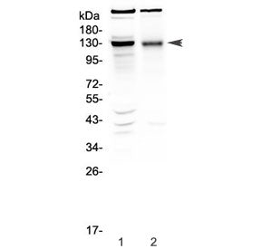 Western blot testing of 1) rat brain and 2) mouse brain tissue lysate with BMPR2 antibody at 0.5ug/m
