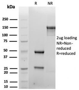 SDS-PAGE analysis of purified, BSA-free recombinant SDC1 antibody (clone rSDC1/6866) as confirmation