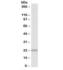 Western blot testing of human thymus lysate with PSMB9 antibody at 1ug/ml. Predicted molecular weigh