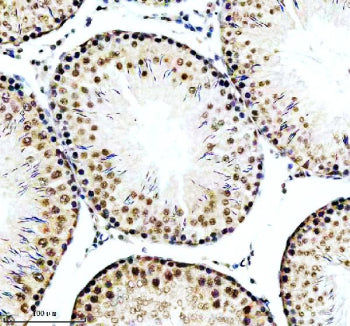 IHC analysis of RBBP6 using anti-RBBP6 antibody. RBBP6 was detected in a paraffin-embedded section o