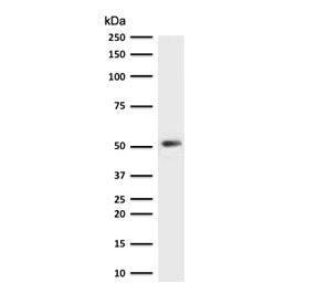 Western blot testing of human HeLa cell lysate with recombinant Cytokeratin 7 antibody (clone CTKN7-