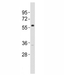 Western blot testing of VANGL2 antibody at 1:2000 dilution + DU145 lysate; Predicted molecular weigh