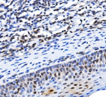 IHC staining of FFPE human tonsil tissue with TBP associated factor 4 antibody. HIER: boil tissue se