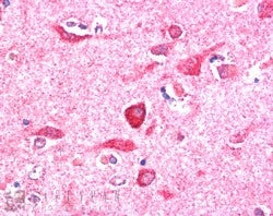 IHC testing of FFPE human cerebral cortex with PITPNM3 antibody at 5ug/ml. HIER: steamed with pH6 ci
