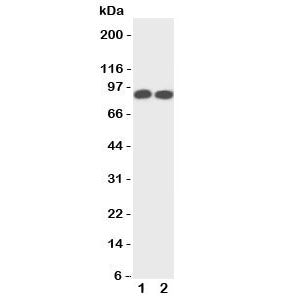 TrkA Antibody (NTRK1)