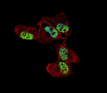 Immunofluorescent staining of fixed and permeabilized human MDA-MB-231 cells with ZNF202 antibody (g