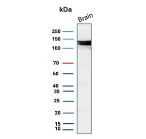 Western blot testing of human brain tissue lysate with Hexokinase 1 antibody (clone HK1/9517). Predi