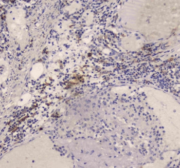 DC-SIGN Antibody / CD209