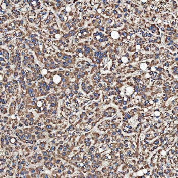 SH2D4A Antibody / PPP1R38