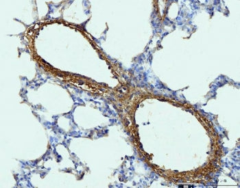 IHC staining of FFPE rat lung tissue with Collagen I antibody. HIER: boil tissue sections in pH8 EDT