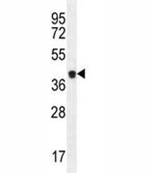 Caspase-5 Antibody, 0.4ml