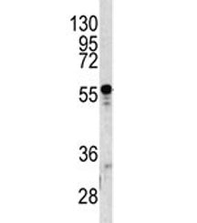 A1BG Antibody