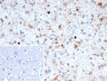 IHC staining of FFPE human brain tissue with Beta Amyloid antibody (clone APP/4469). Inset: PBS used