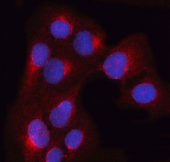 OSTF1 Antibody / Osteoclast-stimulating factor 1