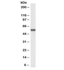 Western blot testing of mouse liver lysate with biotinylated ALDH2 antibody at 0.3ug/ml. Predicted m