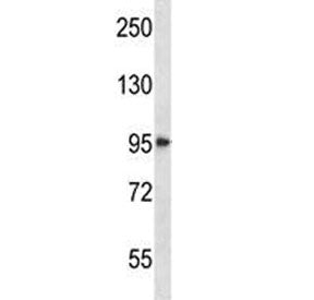 HDAC4 antibody western blot analysis in NCI-H292 lysate. Expected molecular weight: ~140 kDa (full l