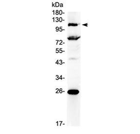 Western blot testing of human 22RV1 cell lysate with NFAT4 antibody at 0.5ug/ml. Predicted molecular