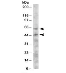 Western blot testing of HeLa lysate with TERF1 antibody at 2ug/ml. Predicted molecular weight: ~50/4