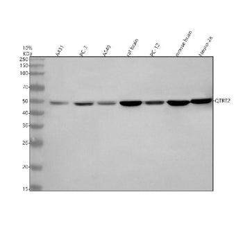 Western blot analysis of QTRT2 using anti-QTRT2 antibody. Electrophoresis was performed on a 10% SDS